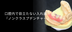 ノンクラスプデンチャーのコラムトップ画像