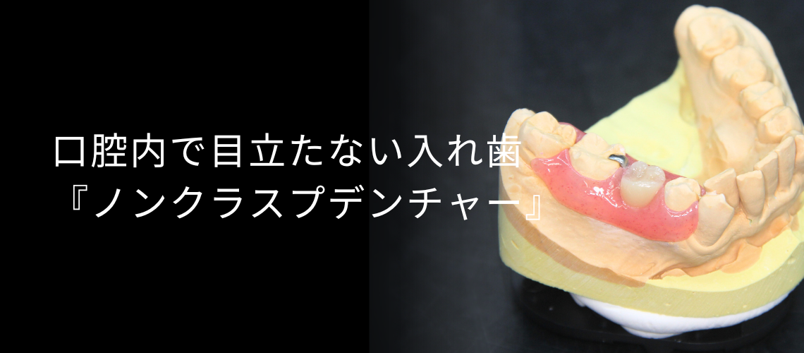 ノンクラスプデンチャーのコラムトップ画像